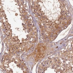 Invitrogen SOD3 Polyclonal Antibody 100 &mu;L; Unconjugated:Antibodies,