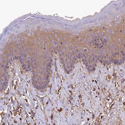 Invitrogen SOD3 Polyclonal Antibody 100 &mu;L; Unconjugated:Antibodies,