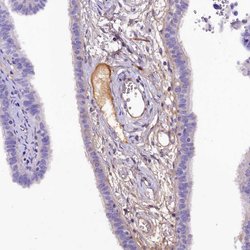 Invitrogen SOD3 Polyclonal Antibody 100 &mu;L; Unconjugated:Antibodies,