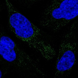 Invitrogen MRPS34 Polyclonal Antibody 100 &mu;L; Unconjugated:Antibodies,