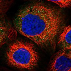Invitrogen PPP2R2B Polyclonal Antibody 100 &mu;L; Unconjugated:Antibodies,
