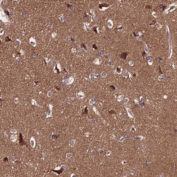 Invitrogen PPP2R2B Polyclonal Antibody 100 &mu;L; Unconjugated:Antibodies,