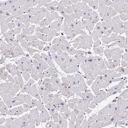 Invitrogen PPP2R2B Polyclonal Antibody 100 &mu;L; Unconjugated:Antibodies,