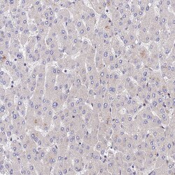 Invitrogen PPP2R2B Polyclonal Antibody 100 &mu;L; Unconjugated:Antibodies,