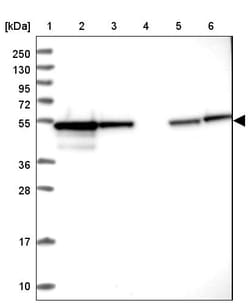 Invitrogen PPP2R2B Polyclonal Antibody 100 &mu;L; Unconjugated:Antibodies,