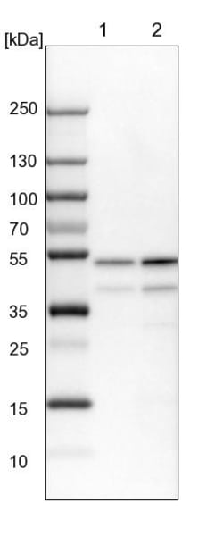 Invitrogen PPP2R2B Polyclonal Antibody 100 &mu;L; Unconjugated:Antibodies,