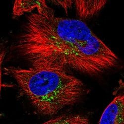 Invitrogen SLC39A3 Polyclonal Antibody 100 &mu;L; Unconjugated:Antibodies,