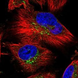 SLC39A3 Polyclonal Antibody, Invitrogen&trade; 100 &mu;L; Unconjugated 