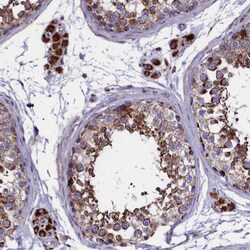 Invitrogen SLC39A3 Polyclonal Antibody 100 &mu;L; Unconjugated:Antibodies,