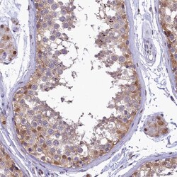 Invitrogen IZUMO2 Polyclonal Antibody 100 &mu;L; Unconjugated:Antibodies,