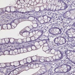 Invitrogen C20orf107 Polyclonal Antibody 100 &mu;L; Unconjugated:Antibodies,