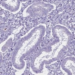 Invitrogen C20orf107 Polyclonal Antibody 100 &mu;L; Unconjugated:Antibodies,