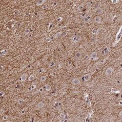 Invitrogen REXO1 Polyclonal Antibody 100 &mu;L; Unconjugated:Antibodies,