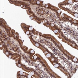 Invitrogen REXO1 Polyclonal Antibody 100 &mu;L; Unconjugated:Antibodies,