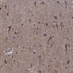 Invitrogen GTPBP3 Polyclonal Antibody 100 &mu;L; Unconjugated:Antibodies,