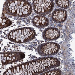 Invitrogen GTPBP3 Polyclonal Antibody 100 &mu;L; Unconjugated:Antibodies,