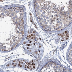 Invitrogen GTPBP3 Polyclonal Antibody 100 &mu;L; Unconjugated:Antibodies,