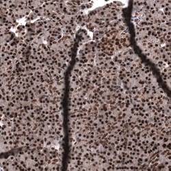 Invitrogen SNRK Polyclonal Antibody 100 &mu;L; Unconjugated:Antibodies,