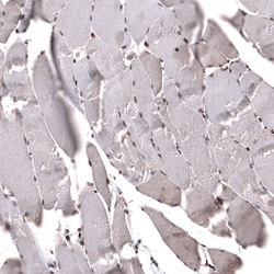 Invitrogen SNRK Polyclonal Antibody 100 &mu;L; Unconjugated:Antibodies,