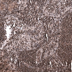 Invitrogen SNRK Polyclonal Antibody 100 &mu;L; Unconjugated:Antibodies,