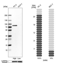 Invitrogen SNRK Polyclonal Antibody 100 &mu;L; Unconjugated:Antibodies,