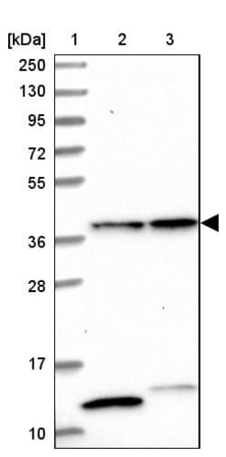 Invitrogen CIAPIN1 Polyclonal Antibody 100 &mu;L; Unconjugated:Antibodies,