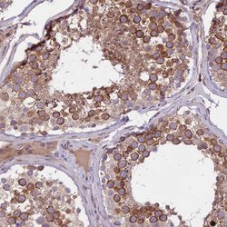 Invitrogen F1A alpha Polyclonal Antibody 100 &mu;L; Unconjugated:Antibodies,