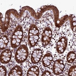 Invitrogen RPUSD2 Polyclonal Antibody 100 &mu;L; Unconjugated:Antibodies,