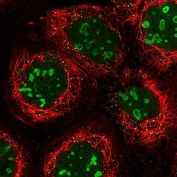 Invitrogen DTWD1 Polyclonal Antibody 100 &mu;L; Unconjugated:Antibodies,