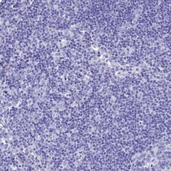 Invitrogen Aquaporin 12 Polyclonal Antibody 100 &mu;L | Buy Online | Invitrogen&trade; | Fisher Scientific