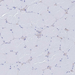 Invitrogen Aquaporin 12 Polyclonal Antibody 100 &mu;L | Buy Online | Invitrogen&trade; | Fisher Scientific