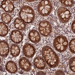 Invitrogen ZNF480 Polyclonal Antibody 100 &mu;L | Buy Online | Invitrogen&trade; | Fisher Scientific