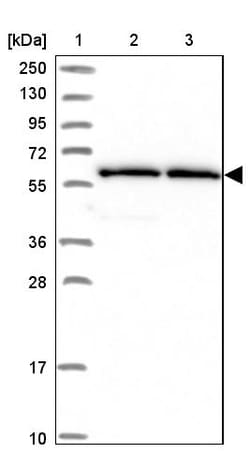 Invitrogen ZNF480 Polyclonal Antibody 100 &mu;L | Buy Online | Invitrogen&trade; | Fisher Scientific