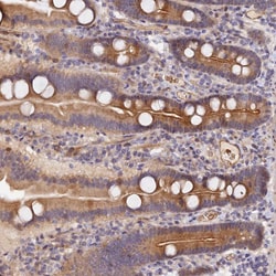 Invitrogen MISP3 Polyclonal Antibody 100 &mu;L; Unconjugated:Antibodies,