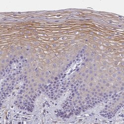 Invitrogen MVB12A Polyclonal Antibody 100 &mu;L; Unconjugated:Antibodies,