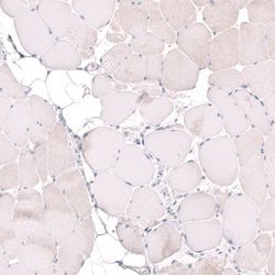 Invitrogen MGA Polyclonal Antibody 100 &mu;L; Unconjugated:Antibodies,