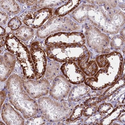 Invitrogen IL20RA Polyclonal Antibody 100 &mu;L; Unconjugated:Antibodies,