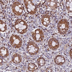 Invitrogen EDAR Polyclonal Antibody 100 &mu;L; Unconjugated:Antibodies,