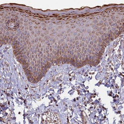 Invitrogen EDAR Polyclonal Antibody 100 &mu;L; Unconjugated:Antibodies,