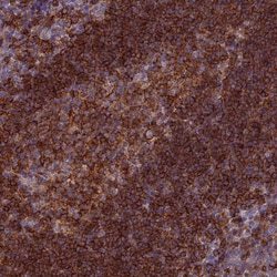 Invitrogen EDAR Polyclonal Antibody 100 &mu;L; Unconjugated:Antibodies,