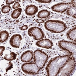 Invitrogen CENPE Polyclonal Antibody 100 &mu;L; Unconjugated:Antibodies,