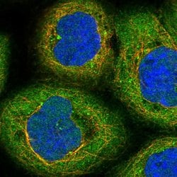 Invitrogen CENPE Polyclonal Antibody 100 &mu;L; Unconjugated:Antibodies,