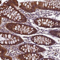 Invitrogen HECA Polyclonal Antibody 100 &mu;L; Unconjugated:Antibodies,