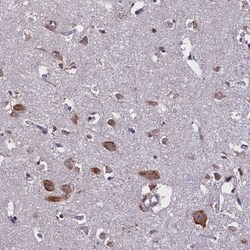 Invitrogen&trade;&nbsp;KCNE1L Polyclonal Antibody