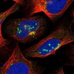 Invitrogen SUR1 Polyclonal Antibody 100 &mu;L; Unconjugated:Antibodies,