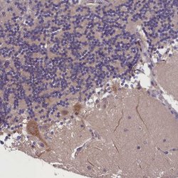 Invitrogen SUR1 Polyclonal Antibody 100 &mu;L; Unconjugated:Antibodies,