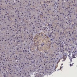 Invitrogen SUR1 Polyclonal Antibody 100 &mu;L; Unconjugated:Antibodies,
