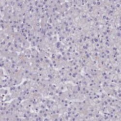 Invitrogen SUR1 Polyclonal Antibody 100 &mu;L; Unconjugated:Antibodies,