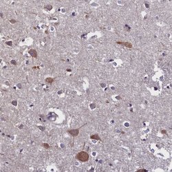 Invitrogen SUR1 Polyclonal Antibody 100 &mu;L; Unconjugated:Antibodies,