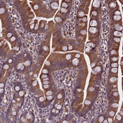 Invitrogen SMCR7 Polyclonal Antibody 100 &mu;L; Unconjugated:Antibodies,